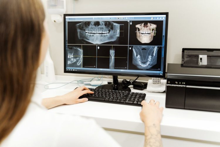 Analiza zdjęcia RTG zębów na monitorze komputera
